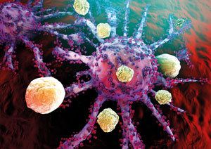 Schwarzer Hautkrebs - Melanom: Krebszelle