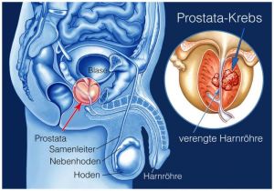 prostata anatomie bild)