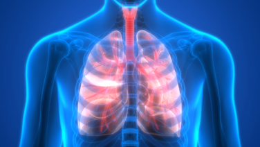 Lungenkarzinom - KRAS-Zieltherapien beim NSCLC